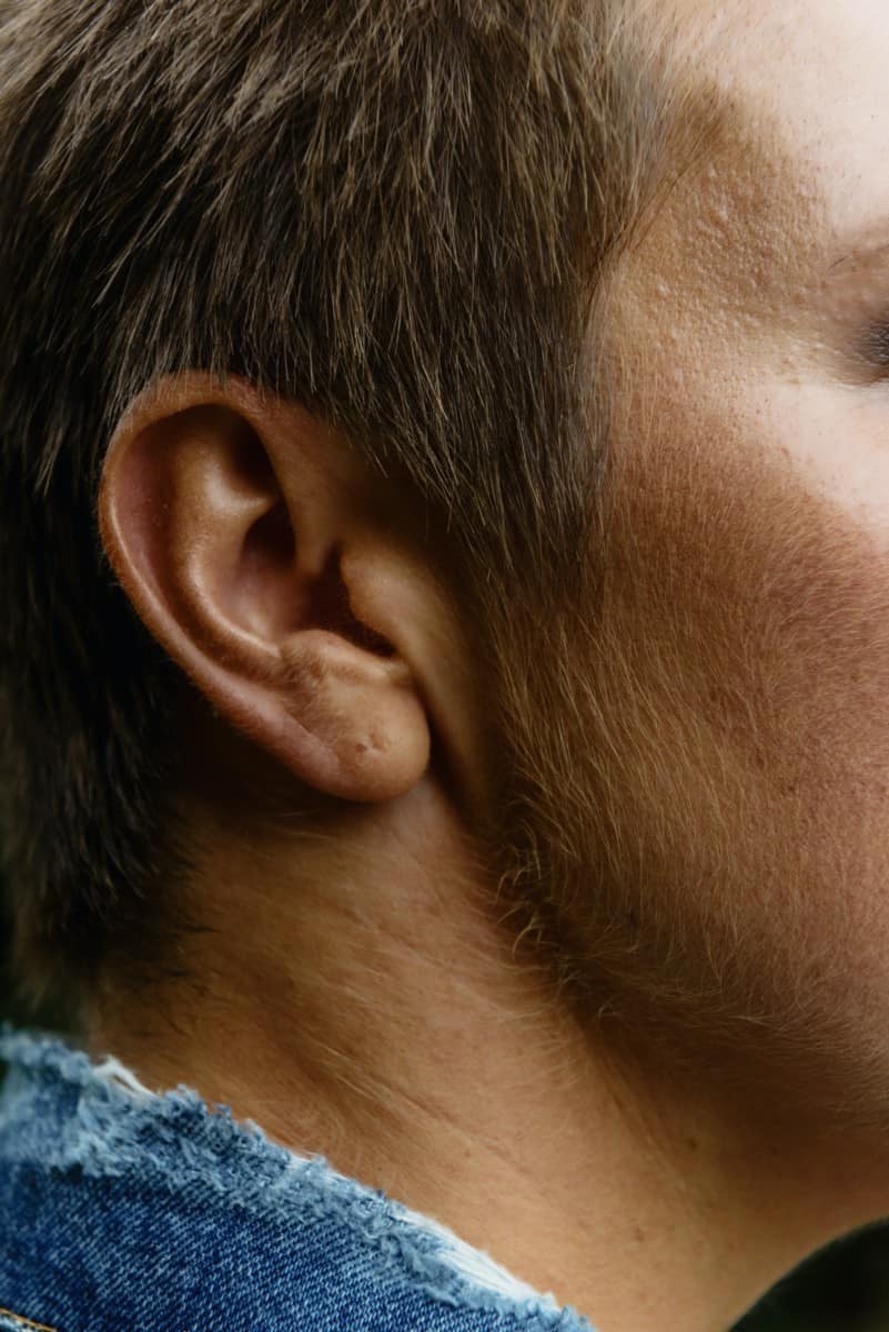 How to Remove Hair from Ears Naturally